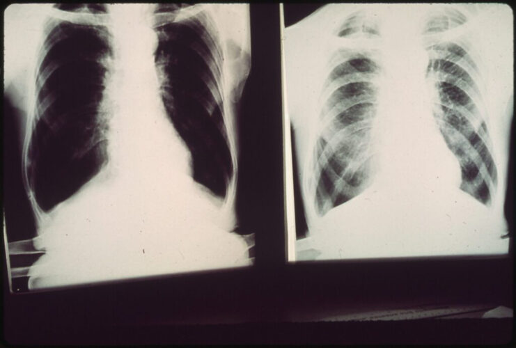 Bill introduced to increase black lung benefit stipends for coal miners in Pa., beyond